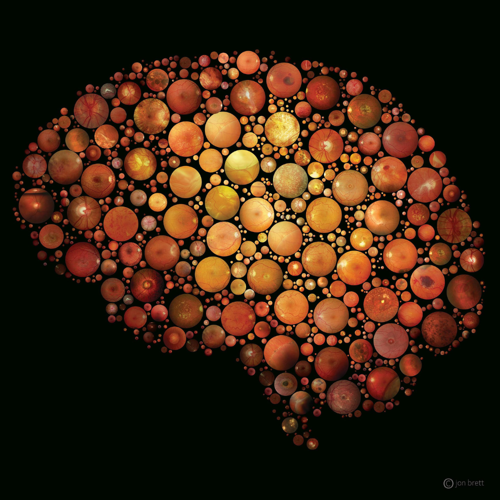 An image of the brain created from multiple images of different pictures of retinas (back of the eye) with different diseases. Copyright Jon Brett.